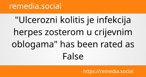 Review of the Claim: Ulcerozni kolitis je infekcija herpes zosterom u crijevnim oblogama